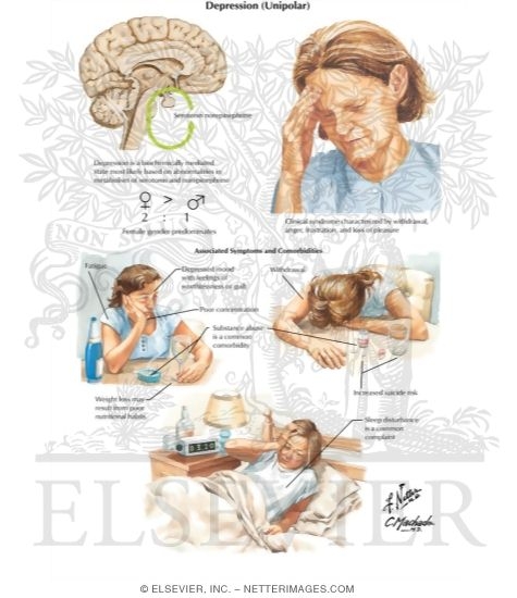 Watermarked preview of labeled image: Depression (Unipolar)