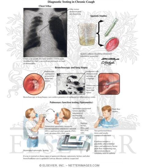 Diagnostic Testing In Chronic Cough