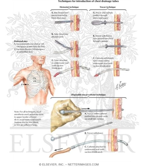 Watermarked preview of labeled image: Vancomycin Resistance