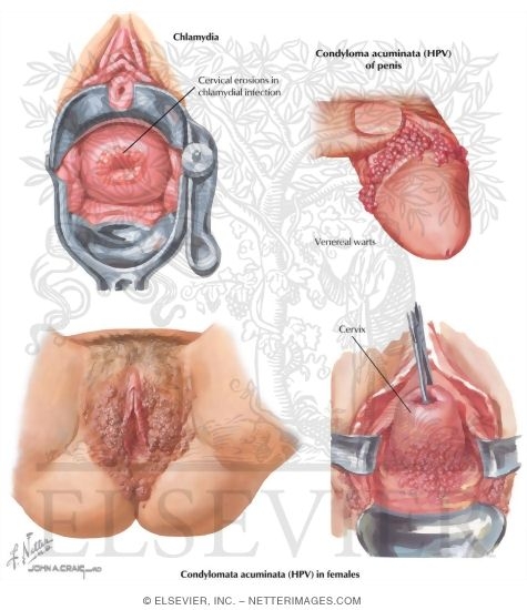 Sexually Transmitted Diseases