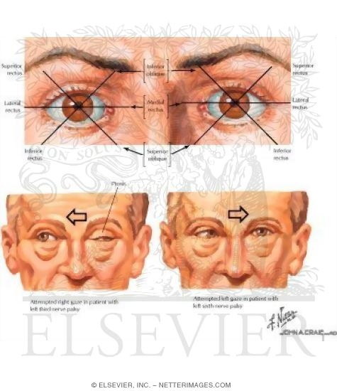 General Testing of Extraocular Muscles