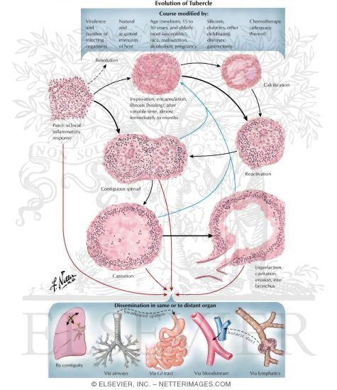 Evolution of Tubercle
