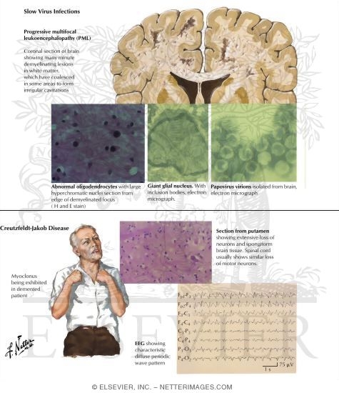 Slow Virus Infections