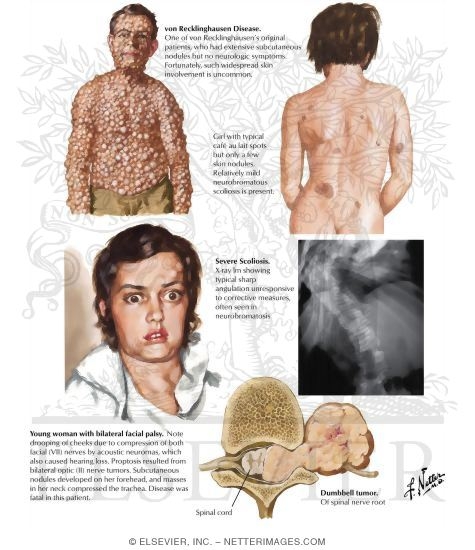 Welcome To Netter Images