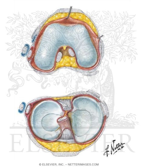Watermarked preview of unlabeled image: Knee Joints