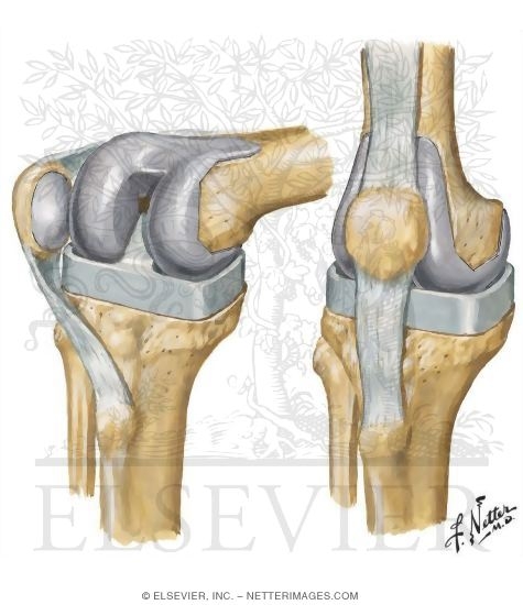 Watermarked preview of unlabeled image: Total Knee Arthroplasty