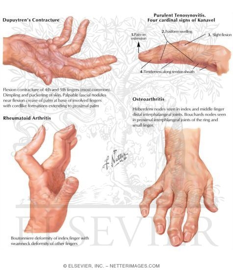 Watermarked preview of labeled image: Physical Examination of the Hand