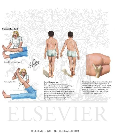 Watermarked preview of labeled image: Physical Exam of the Pelvis