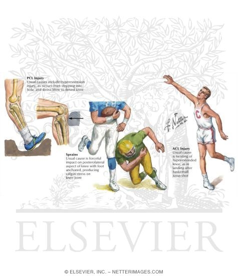 Watermarked preview of labeled image: Medical History of the Leg and Knee