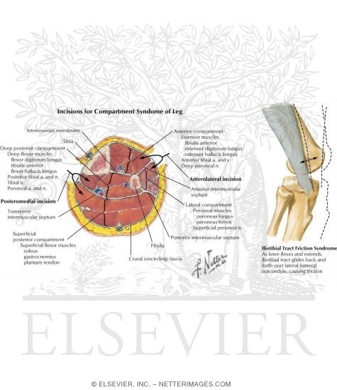 Watermarked preview of labeled image: Disorders of the Leg and Knee