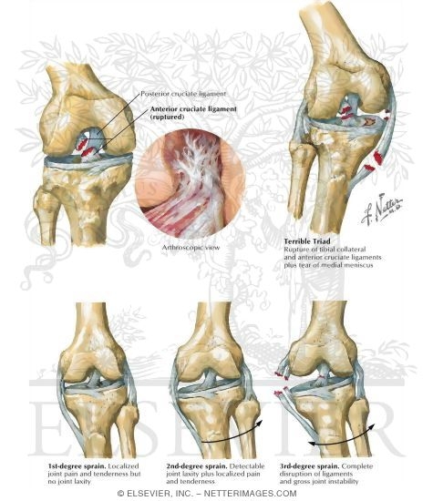 Watermarked preview of labeled image: Disorders of the Leg and Knee