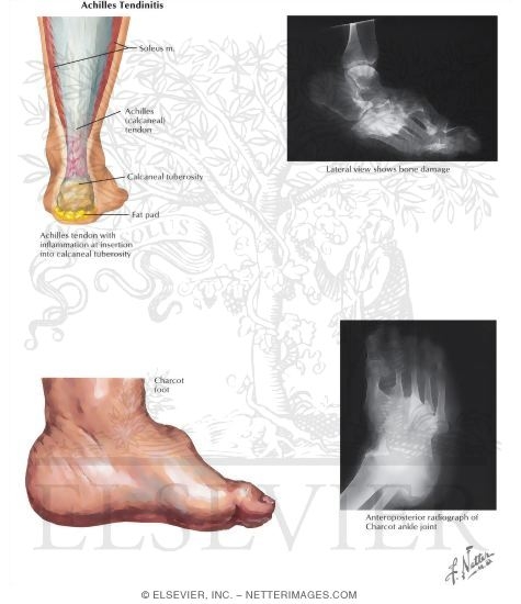 Watermarked preview of labeled image: Disorders of the Foot and Ankle