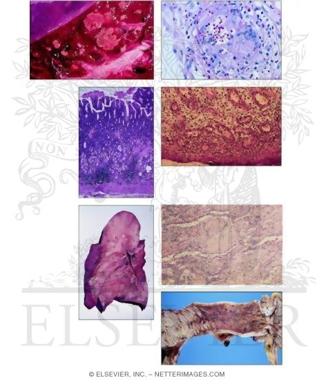 Watermarked preview of unlabeled image: Chronic Inflammation