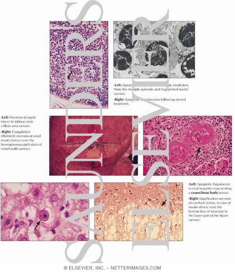 Apoptosis and Necrosis