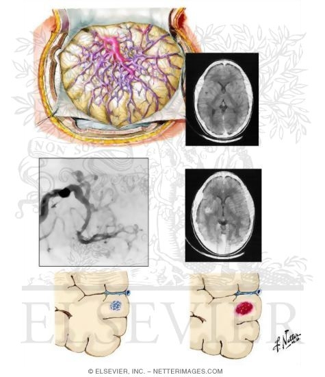 Watermarked preview of unlabeled image: Vascular Malformations