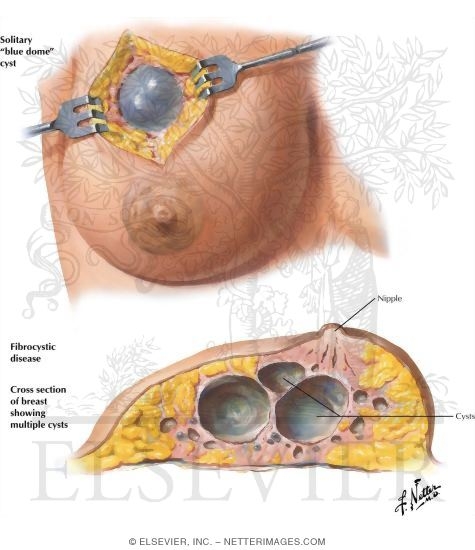 Welcome To Netter Images
