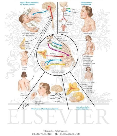 Watermarked preview of labeled image: Galactorrhea