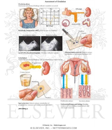 Watermarked preview of labeled image: Assessment of Ovulation