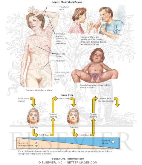 Watermarked preview of labeled image: Abuse: Physical and Sexual