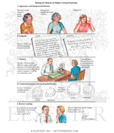 Watermarked preview of labeled image: Alzheimer's Disease