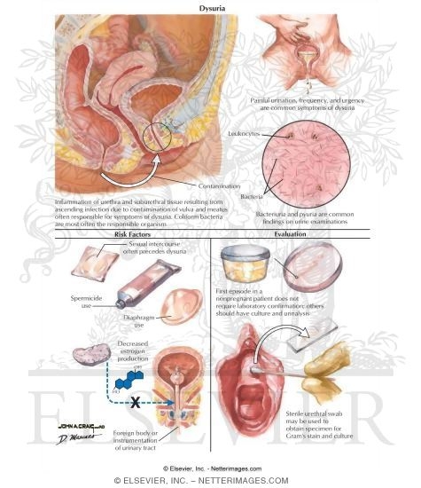 Watermarked preview of labeled image: Dysuria