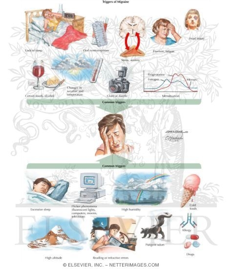 Watermarked preview of labeled image: Headache: Tension, Cluster, and Migraine