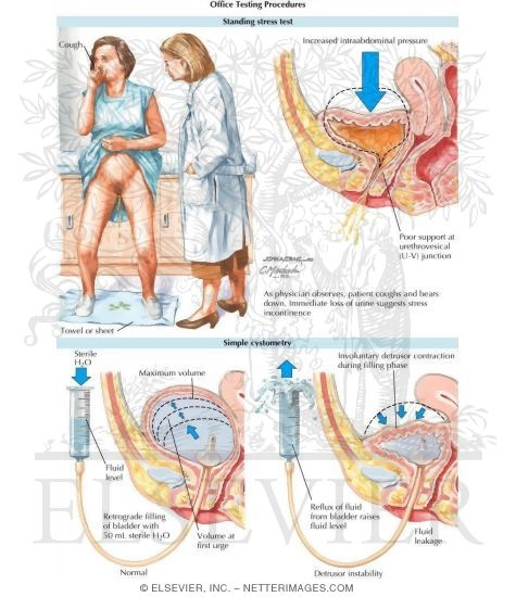 Watermarked preview of labeled image: Urodynamics Testing
Office Testing Procedures