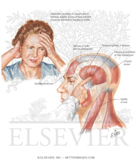 Watermarked preview of labeled image: Palpation of the Temporalis Muscle
