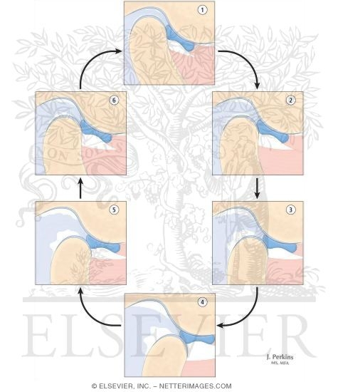 Watermarked preview of labeled image: Combined Tests for Detecting Anterior Disc Displacement Without Reduction