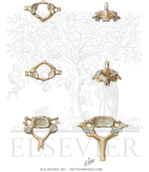 Watermarked preview of unlabeled image: Cervical Spine