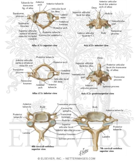 cervical vertebrae labeled axis