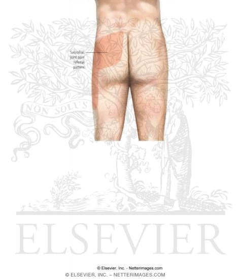 Sacroiliac Joint Pain Referral Patterns