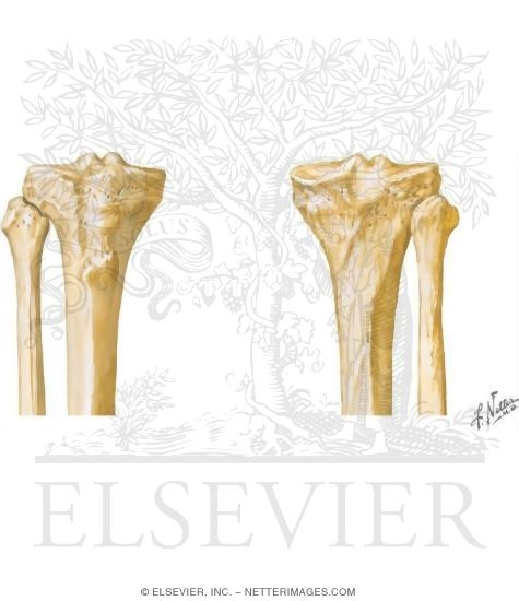 Tibia and Fibula