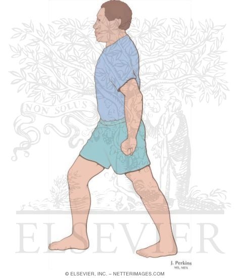 Measurement of Dorsiflexion With Modified Lunge Test