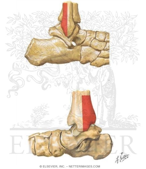Ottawa Ankle Rules