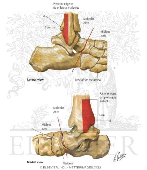 Watermarked preview of labeled image: Ottawa Ankle Rules