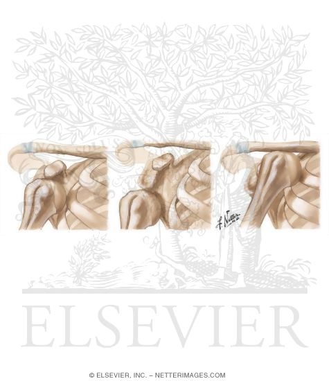 Shoulder Instability