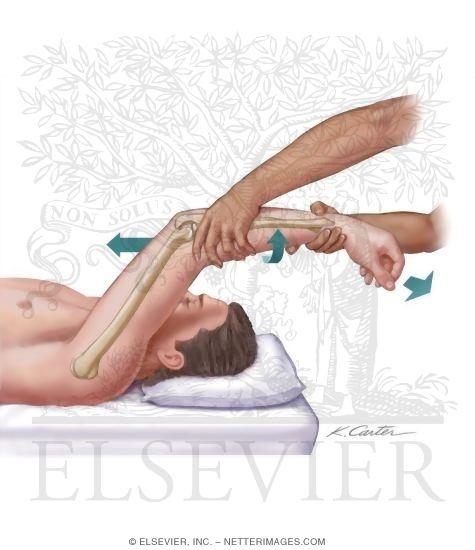 Watermarked preview of unlabeled image: Posterolateral Rotatory Instability