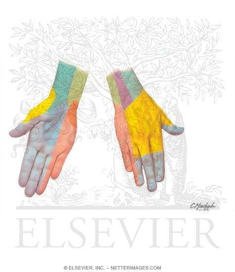 Carpal Tunnel Syndrome: Sensory Loss