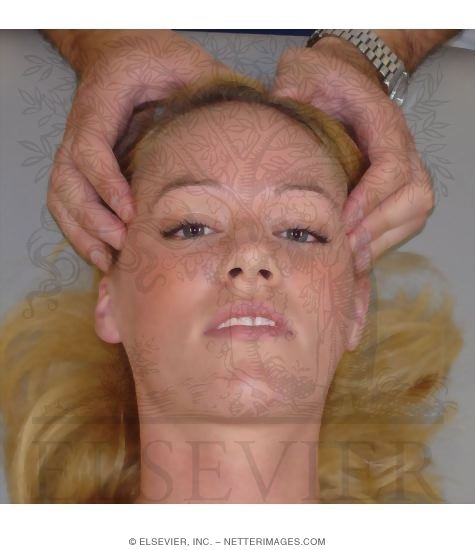 Watermarked preview of unlabeled image: Palpation of the Temporalis