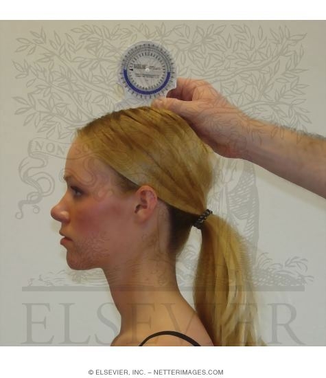 Positioning of Inclinometer to Measure Flexion and Extension