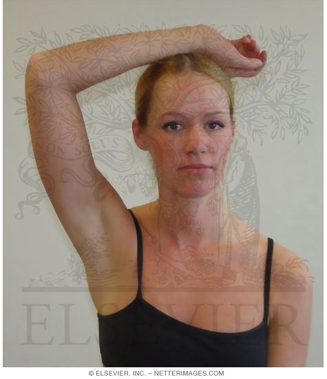 Shoulder Abduction Test