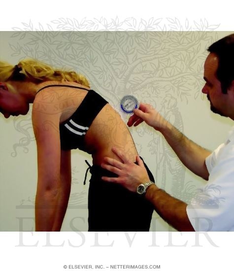 Measurement of Thoracolumbar Flexion
