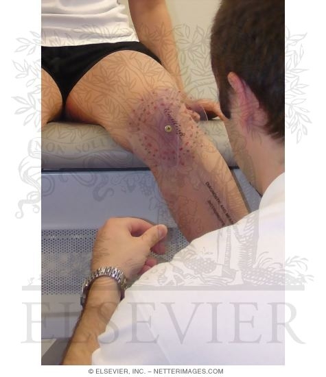 Watermarked preview of unlabeled image: Passive Range-of-Motion Measurements of the Knee