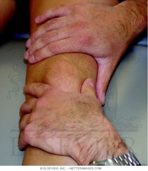 Watermarked preview of unlabeled image: Detecting Cardinal Signs of Inflammation of Knee: Fluctuation Test