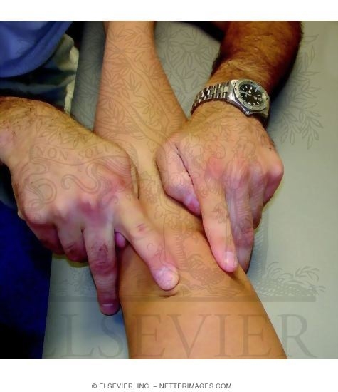 Watermarked preview of unlabeled image: Examination of Mediolateral Patellar Tilt