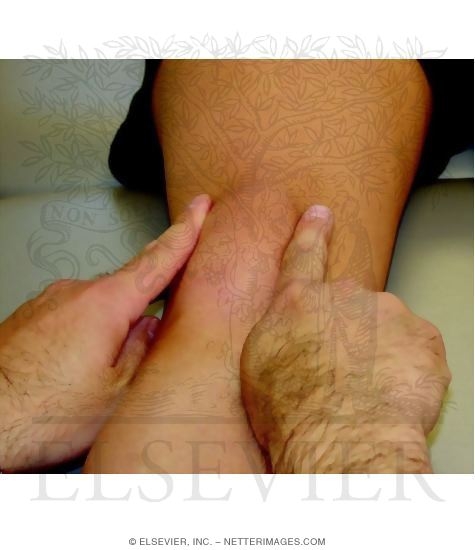 Watermarked preview of unlabeled image: Examination of Patellar Rotation