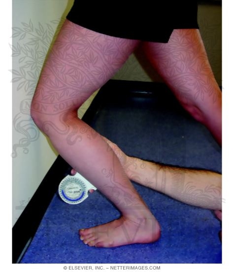Goniometric Measurements: Weight-Bearing Lunge Measurements of Ankle Dorsiflexion