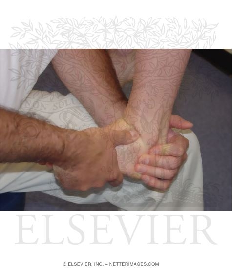 Watermarked preview of unlabeled image: Detecting Anterolateral Ankle Impingement: Impingement Sign, Dorsiflexion