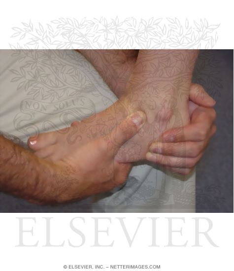 Watermarked preview of unlabeled image: Detecting Anterolateral Ankle Impingement: Impingement Sign, Plantarflexion